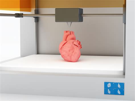 3D Printing in Healthcare