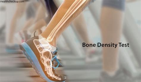 Bone Density Test Preparation