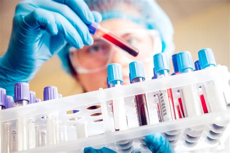Diagnostic Testing and Treatment