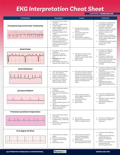 ECG Interpretation