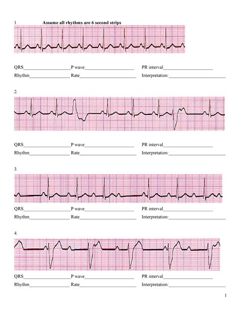 ECG Practice