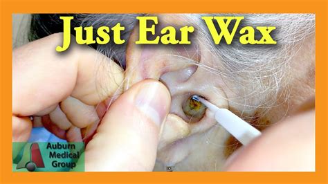 Ear Wax Removal