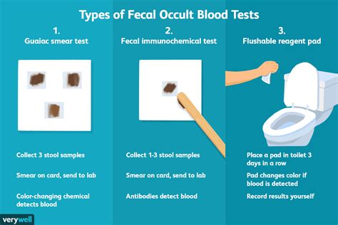 Fecal Occult Blood Test