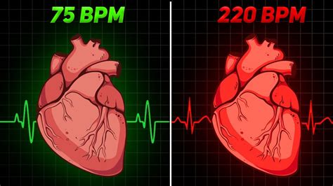 Increased Heart Rate