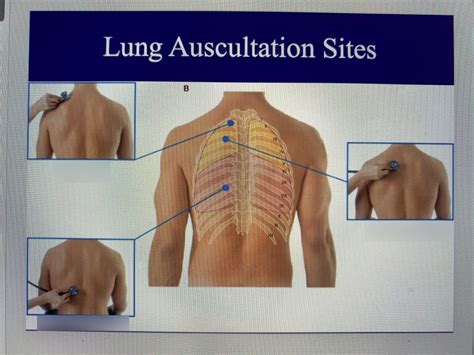 Lung Auscultation Challenges