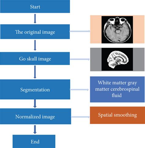 MRI Imaging Process