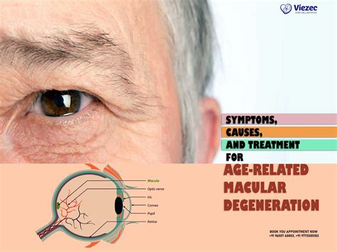 Macular Degeneration Diagnosis and Treatment