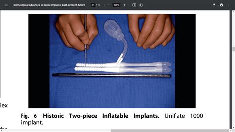 Medical Technology Advancements