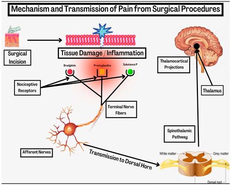 Pain Management CRNA