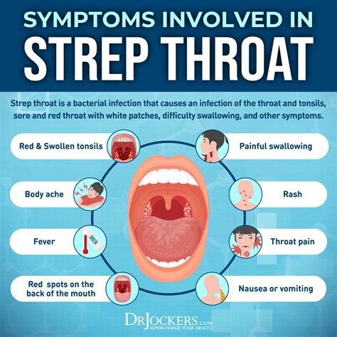 Pharyngitis
