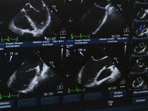 Ultrasound Imaging Process