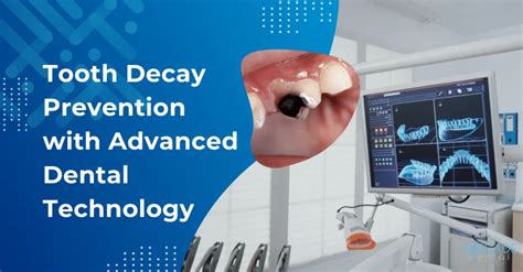 Advanced Dental Technology