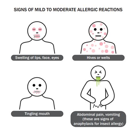 Allergic Reactions