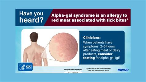 Diagnosing alpha-gal allergy