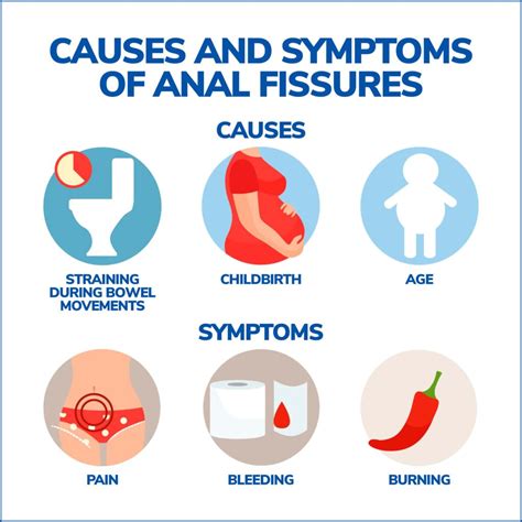 Anal Fissures
