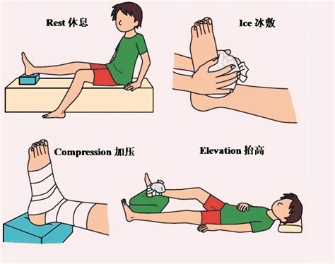 Ankle Sprain RICE Principle