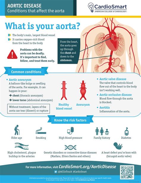 Aorta Symptoms