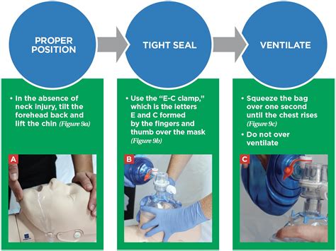 Bag-Mask Ventilation