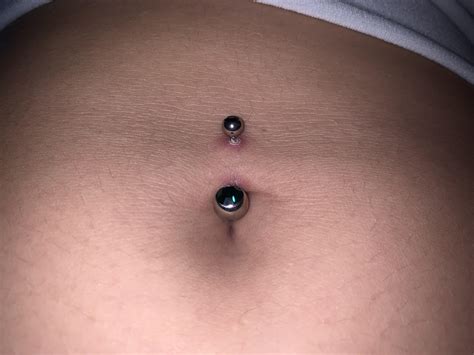 Belly Button Piercing Infections