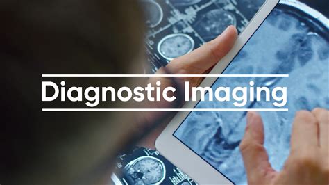 Benefits of Diagnostic Imaging