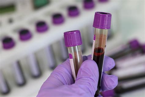 Blood Test Duration