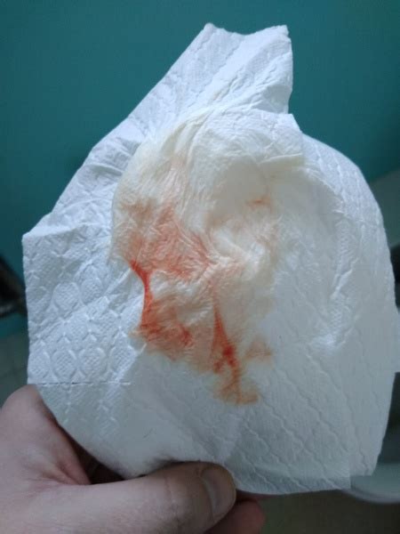 Bloody Show