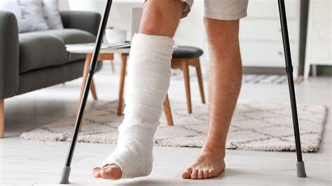 Broken Leg