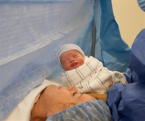 C-section physical health