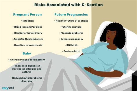 C-section rest and relaxation