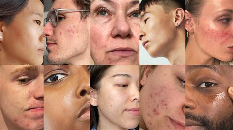 Common Skin Concerns in Franklin, Tennessee