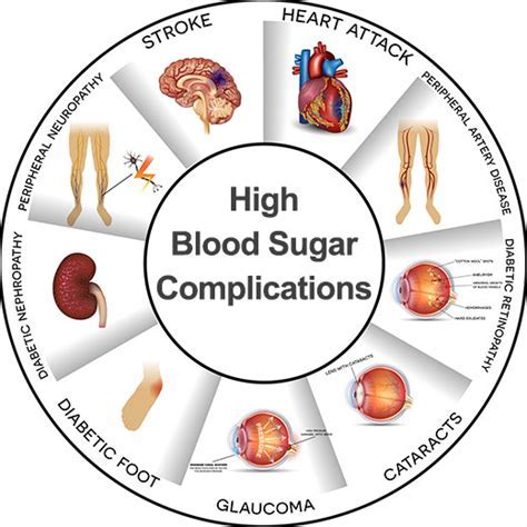 Complications of High Blood Sugar Levels