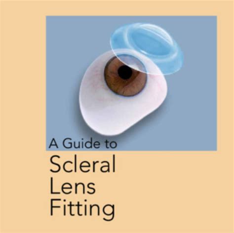 Contact Lens Fit Process