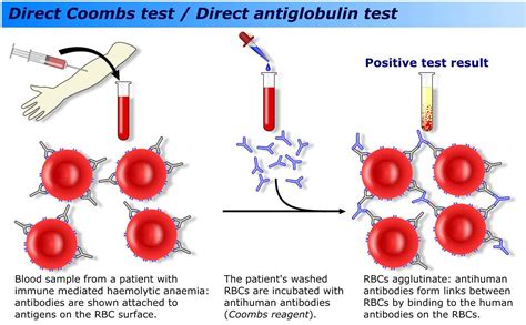 Coombs Test Limitations