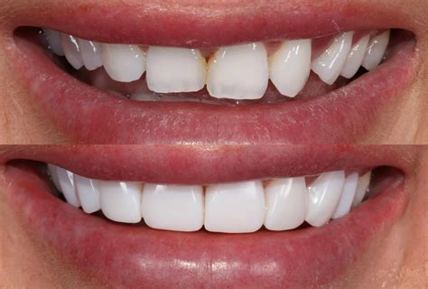 Cosmetic Dentistry