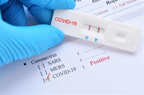COVID-19 testing