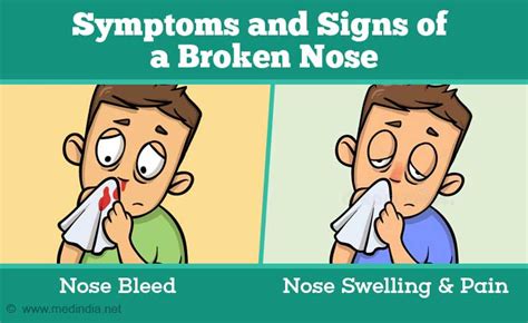 Cracked Nose Symptoms
