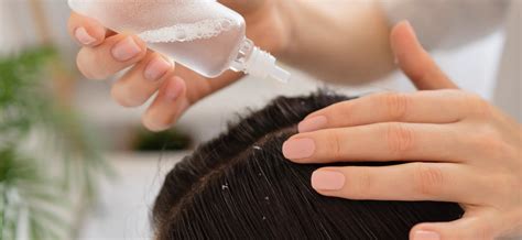 Dandruff Treatment