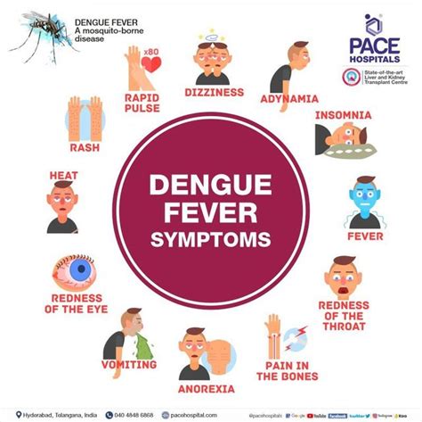 Dengue Fever Symptoms