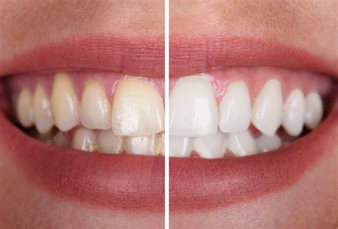 dental wellness