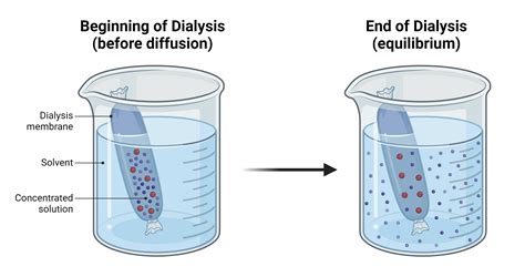 Dialysis machine