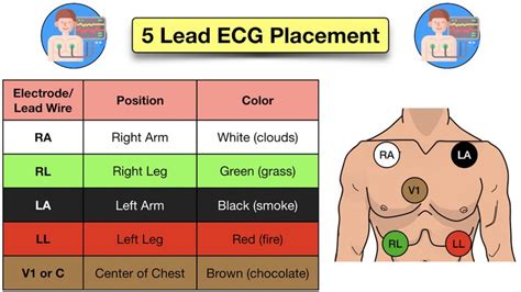ECG Lead Techniques