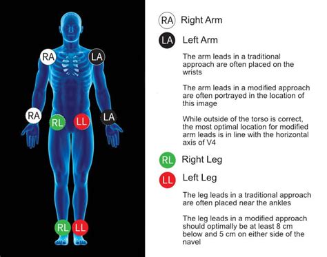 ECG Placement Skills
