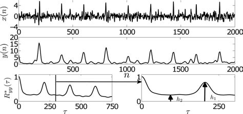 ECG Signal Quality