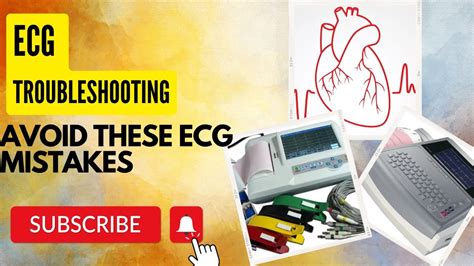 ECG Troubleshooting