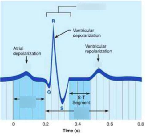 EKG tracing diagram