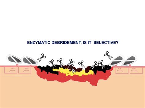 Enzymatic Debridement