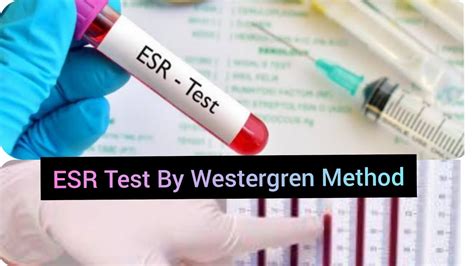ESR procedure by modified Westergren