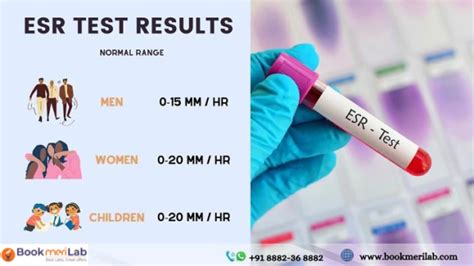 ESR Test Results