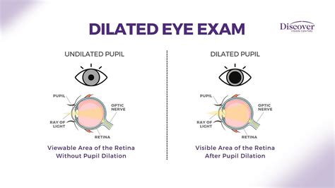 Comprehensive Eye Exam