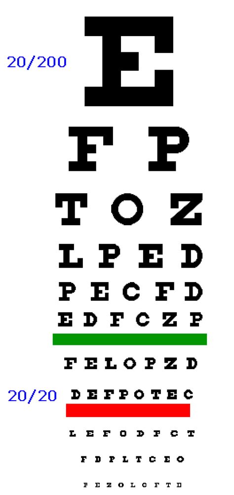 Eye Exam